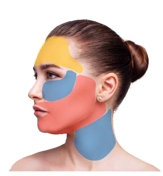 Woman's profile with yellow, blue, and pink color-coded zones on her face and neck.