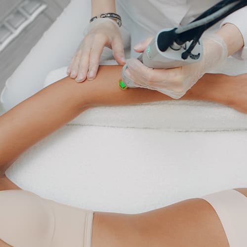 Technician performing laser hair removal on a woman's arm using a professional medical device.