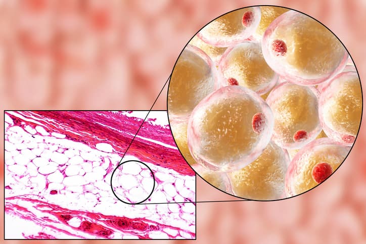 Microscopic cross-section of adipose tissue featuring a detailed 3D zoom-in of spherical fat cells.