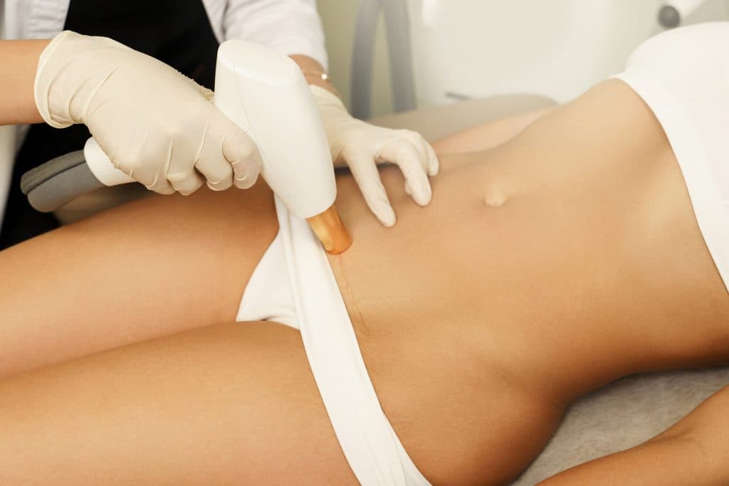 Gloved hands using a laser hair removal device on a woman's bikini line.