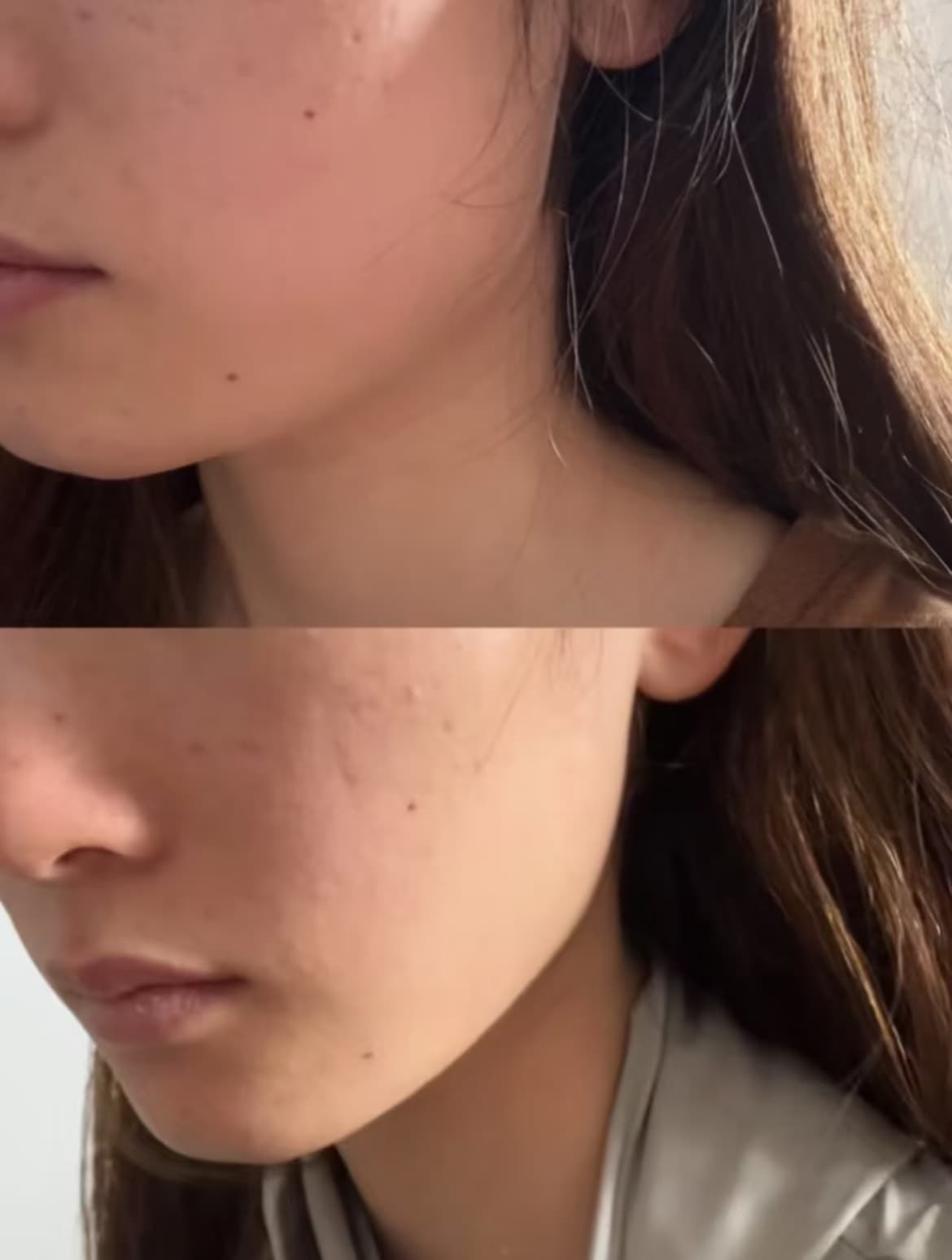 Close-up comparison of a person's cheek showing smooth skin versus skin with visible texture.