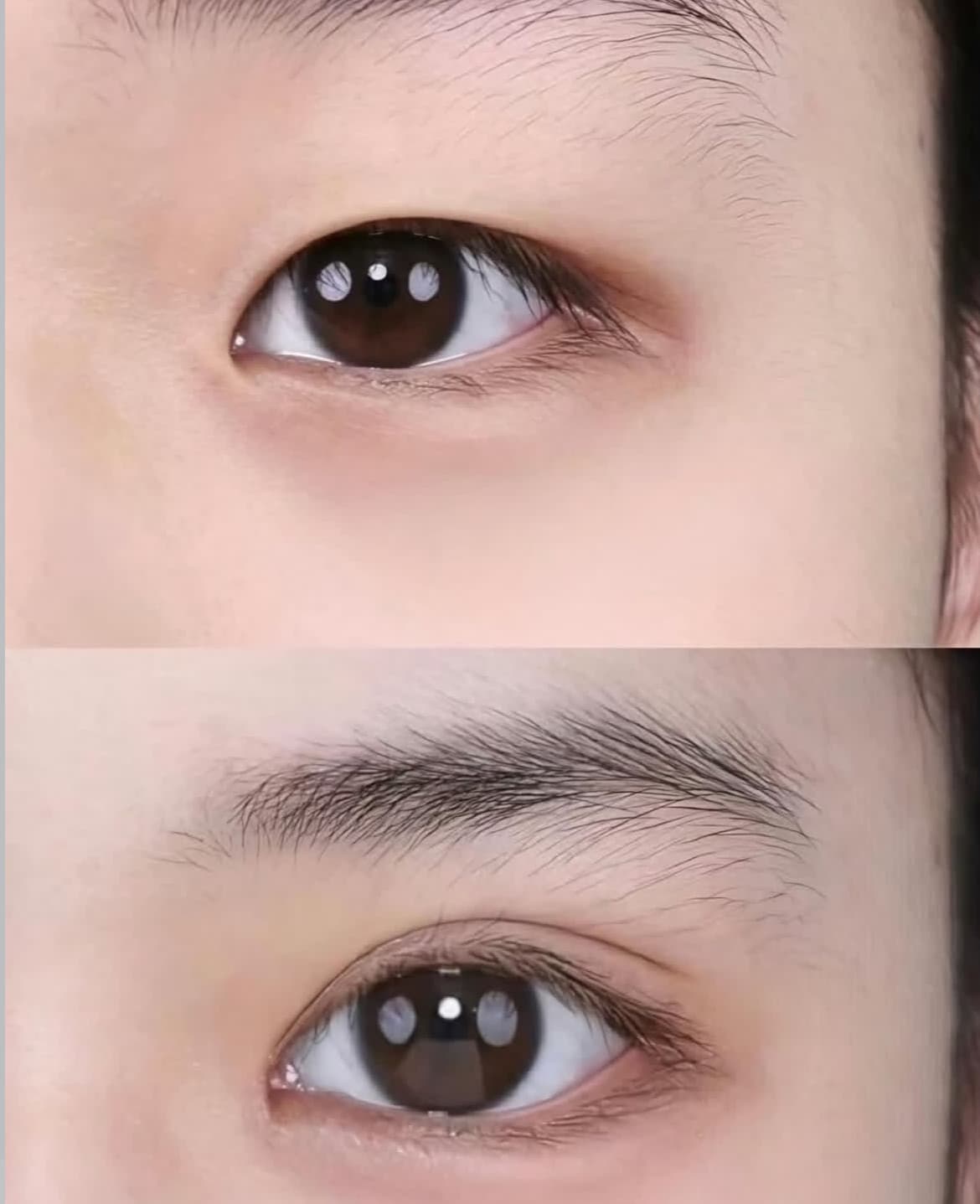 Before and after comparison of an eye showing the transition from monolid to double eyelid.