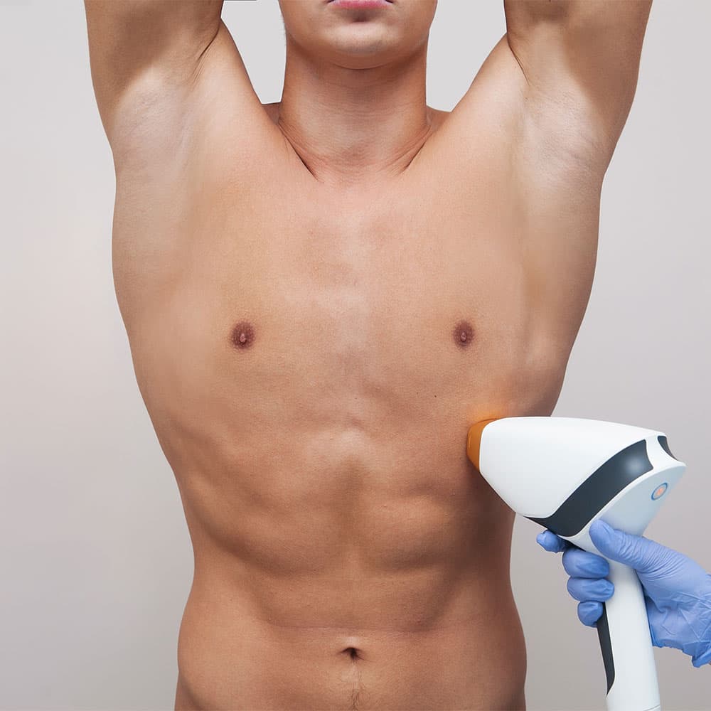 Man receiving laser hair removal treatment on his side from a professional wearing blue gloves.